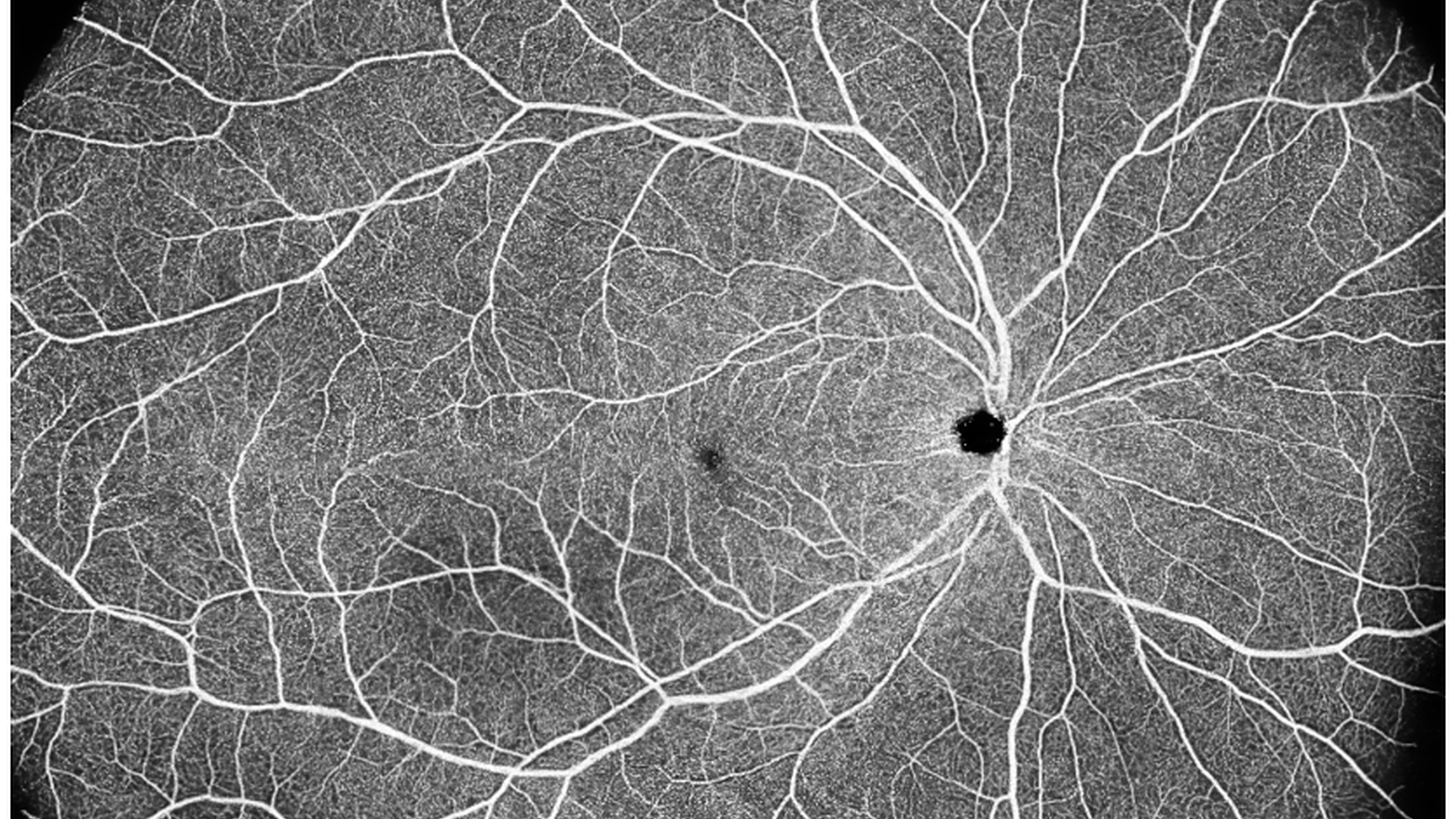 Pré-requis pour démarrer en OCT-Angiographie