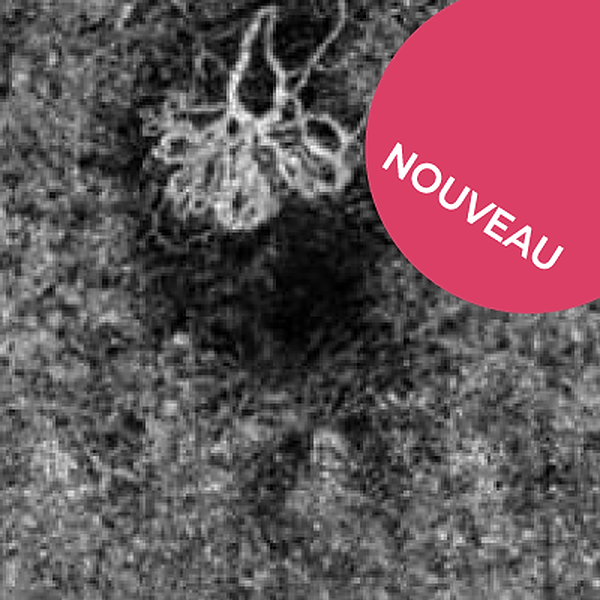 Examens complémentaires : OCT dans la DMLA, Pré-requis en OCT-A,  OCT-A dans la DMLA et CV dans le glaucome