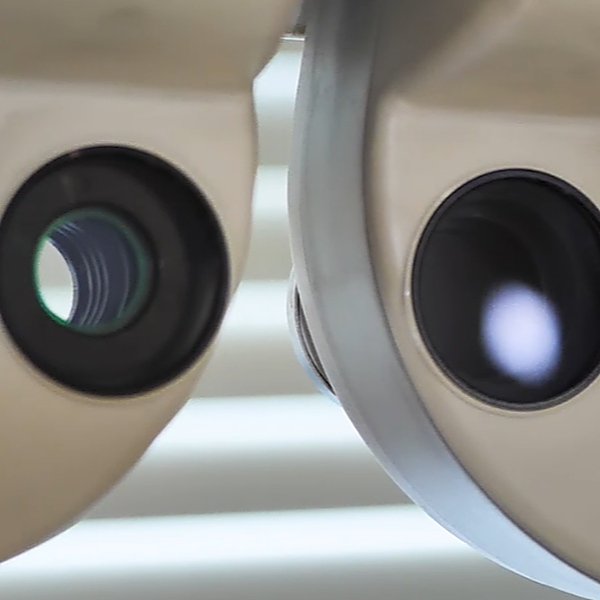 Pré-requis avant une réfraction complexe dans le cadre des protocoles de coopération